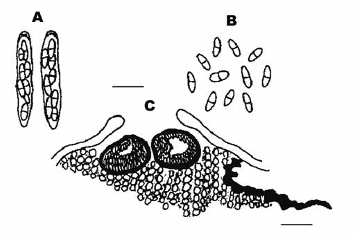 Diaporthe conorum (Desmazieres) Niessl. A. Asci (bar: 20 μm), B. Ascospores (bar: 20 μm), C. Perithecium on Pinus morrisonicola Hayata (bar: 500 μm) 