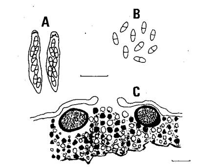 Diaporthe spiculosa (Albertini et Schweinitz) Nitschke. A. Asci (bar: 20 μm), B. Ascospores (bar: 20 μm), C. Perithecium on Rhus succedanea L. (bar: 500 μm) 
