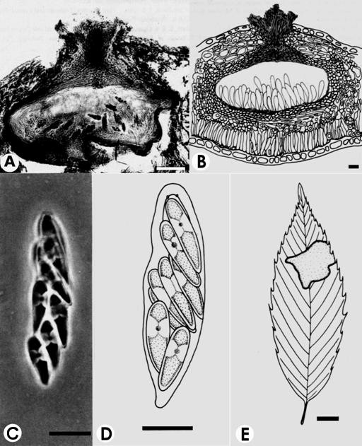 Bagcheea taiwanensis. A-B. V.s. of perithecia with a bristle-like ostiole, bar= 50 μm. C-D. Asci with ascospores, bar= 50 μm. E. Leaf spot on upper surface of leaf, bar=50 μm. 