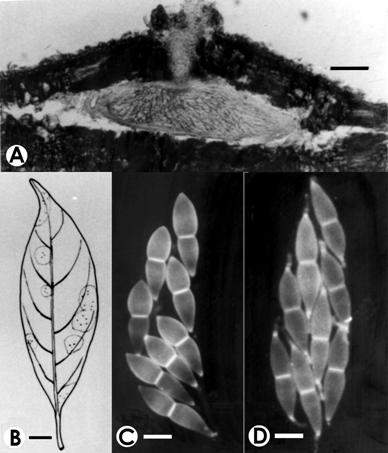 Gnomonia lithocarpicola. A. V.s. of ascoma, bar= 100 μm. B. Infected leaf spots with ascomata, bar= 1cm. C-D. Asci with ascospores, bar=10 μm. 