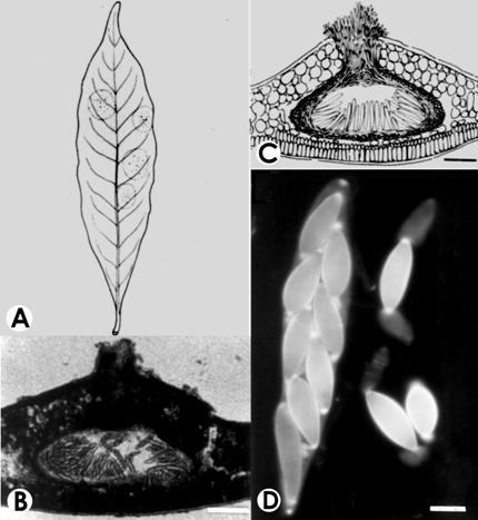 Gnomoniella lithocarpicola. A. Infected leaf with ascomata, bar= 1 cm. B-C. V.s. of ascomata, bar120 μm. D. Ascus with ascospores, bar= 10 μm. 