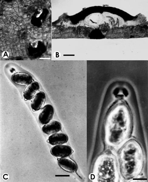 Prostratus cyclobalanopsidis. A. Ascostomata on leaf, bar=500 μm. B. V.s. of ascomata, bar= 50 μm. C & D. Asci and ascospores, bar= 15 μm. 