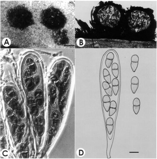 Acantharia chaetomoides. A. Ascomata on leaf (Bar, 800 μm); B. V.s. of ascomata (Bar, 60 μm); C-D. Asci and as cospores (Bar, 12 μm). 