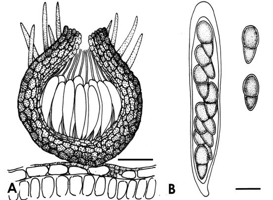 Coleroa petasitidis. A. V.s. of pseudothecium, bar= 35 μm. B. Ascus with ascospores, bar=10 μm. 