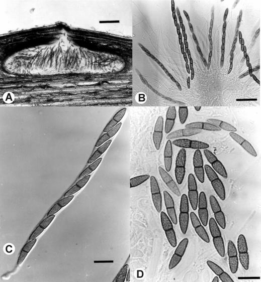 Didymosphaeria spinosa. A. V.s. of ascoma, bar=100 μm. B. Asci, bar= 30 μm. C-D. Asci and ascospores, bar=10 μm. 