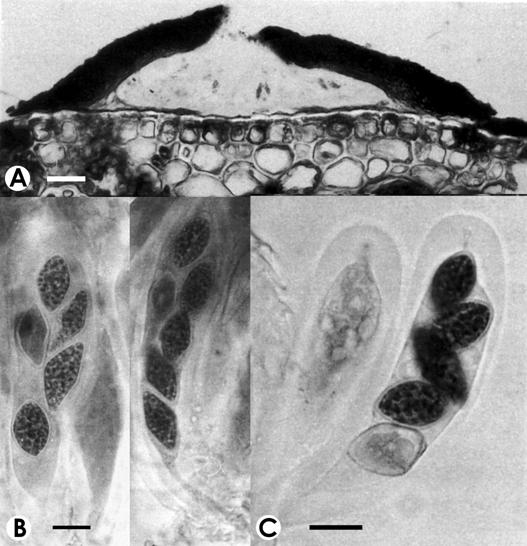 Ellisiodothis cocoicola. A. V.s. of ascostroma, bar= 40 μm. B-C. Asci with ascospores, bar=20 μm. 