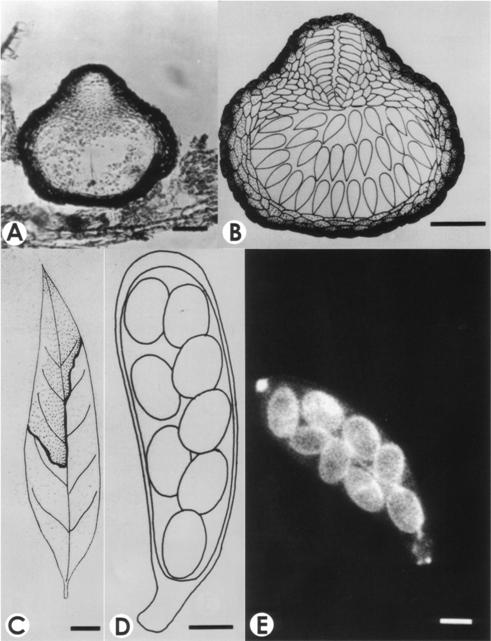 Guignardia castanopsis. A-B. V.s. of ascomata, bar=50 μm. C. Infected leaf with ascomata, bar= 1mm. D-E. Asci with ascospores, bar=5 μm. 