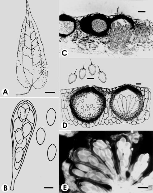 Guignardia clematidis. A. Infected leaf with ascomata, bar= 1 cm. B. Ascus with ascospores, bar=15 μm. C. V.s. of ascoma and pycnidium, bar= 50 μm. D. V.s. of ascoma and ascospores, bar= 10 μm. E. Asci with ascospores in calcofluor, bar= 15 μm. 