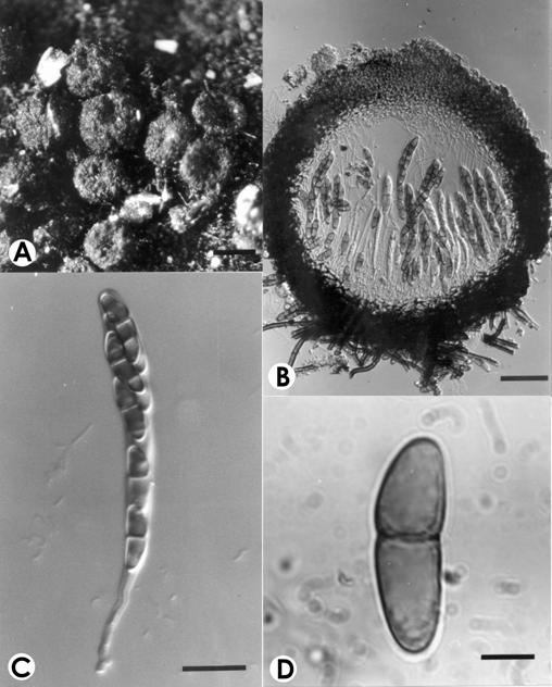 Herpotrichia rhodosticta. A. Ascocarps on host, bar=200 μm. B. V.s. of ascocarp, bar- 50 μm. C. Ascus with ascospores, bar= 20 μm. D. Ascospore, bar=5 μm. 
