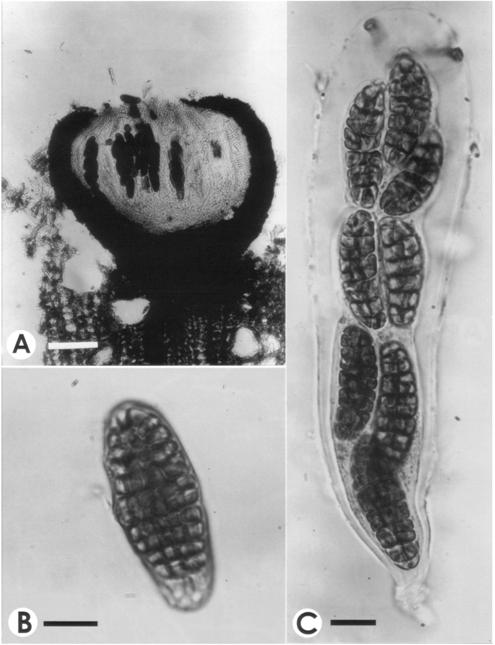 Hysterographium fraxini. A. V.s. of ascoma, bar= 70 μm. B-C. Ascus with as-cospores, bar= 10 μm. 