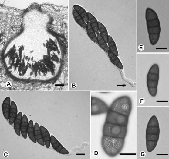 Kalmusia clivensis. A. Section of ascoma, bar= 50 μm. B & C. Asci, bar= 10 μm. D. Asco-spore with ornamentation, bar= 10 μm. E-G. Ascospores, bar= 10 μm. 