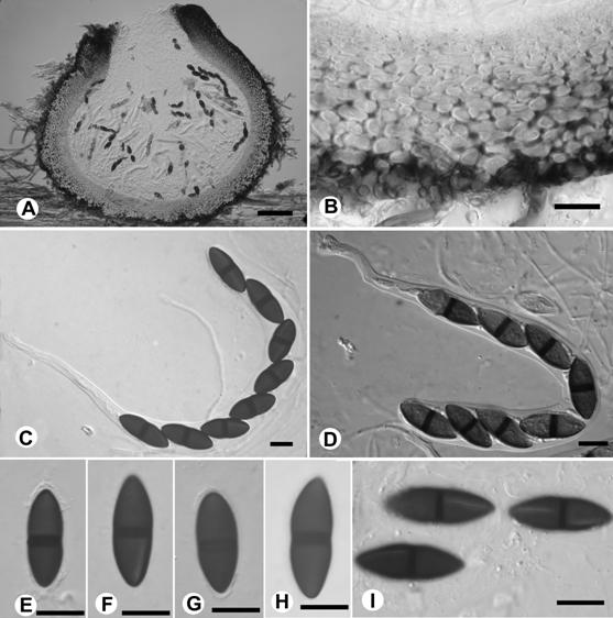 Lojkania melasperma. A. Section of ascoma, bar= 50 μm. B. Peridium, bar= 10 μm. C-D. Asci, bar= 10 μm. E-H. Ascospores, bar= 10 μm. I. Ascospores with germslits, bar= 10 μm. 
