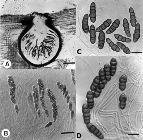 Lophiostoma quadrinucleatum var. triseptatum. A. V.s. of ascoma, bar= 100 μm. B. Asci and pseudoparaphyses, bar= 30 μm. C-D. Ascus and ascospores, bar= 10 μm. 