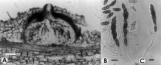 Phaeosphaeria microscopica. A. V.s. of ascoma, bar= 80 μm. B-C. Asci, ascospores and pseudoparaphyses, bar= 10 μm. 