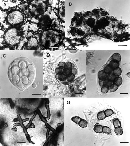 Schiffnerula villebruneae. A. Ascomata and mycelium on surface of leaf, bar= 40 μm. B. V.s. of ascoma, bar= 20 μm. C. Immature ascus, bar= 10 μm. D. Mature ascus, bar= 10 μm. E. Ascus with protruded endotunica, bar= 10 μm. F. Hyphae with hyphopodia, bar= 10 μm. G. aswcospores, bar= 10 μm. 