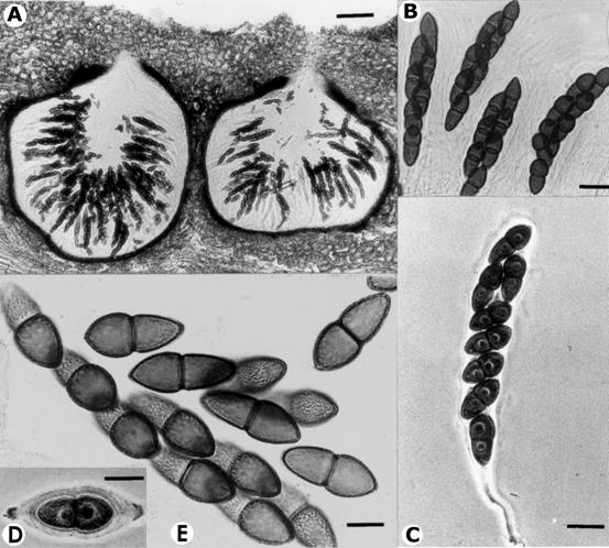 Splanchnonema verruculospora. A. V.s. of pseudothecia, bar= 100 μm. B. Asci with asco-spores and pseudoparaphyses, bar= 20 μm. C. Ascus with ascospores, bar= 20 μm. D. Young ascospore with mucilaginous sheath, bar= 15 μm. E. Ascospores showing verruculation, bar= 10 μm. 