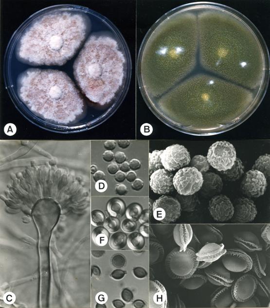Emericella nidulans. A. colonies on CZ, 14 days, at 25°C; B. colonies on MEA, 14 days, at 25°C; C. aspergillum X1340; D. conidia X1830; E. conidia (SEM) X13125; F. Hulle cells X1750; G. ascospores X1670; H. ascospores (SEM) X7920. 