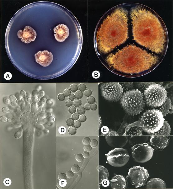 Eurotium herbariorum. A. colonies on CZ, 14 days, at 25°C; B. colonies on C20S, 14 days, at 25°C; C. aspergillum X1400; D. conidia X1280; E. conidia (SEM) X8330; F. ascospores X1430; G. ascospores (SEM) X8920. 