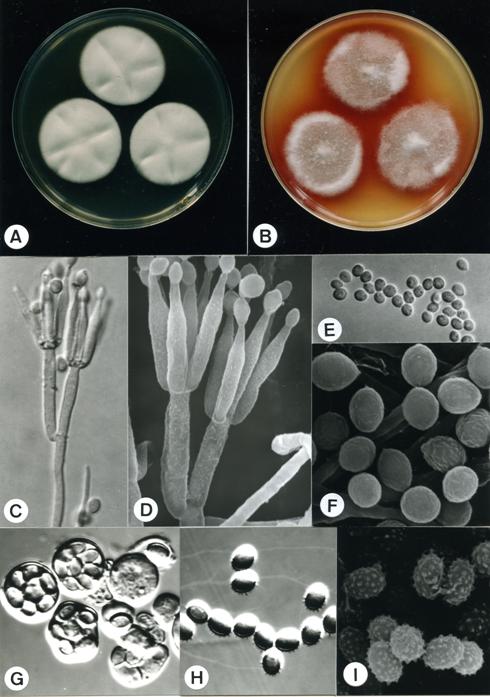 Talaromyces flavus (BCRC 33156). A,B. colonies on CYA and MEA at 25°C, 7 days; C. penicillus X1732; D. penicillus X6875; E. conidia X1925; F. conidia X11719; G. asci X1925; H. ascospores X1815; I. ascospores X11000. 