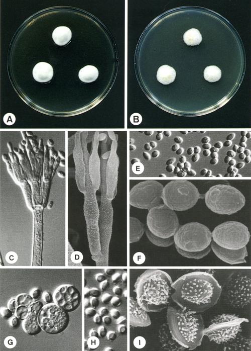 Talaromyces unicus (CCRC 32703). A,B. colonies on CYA and MEA at 25°C, 7 days; C. penicillus X1980; D. penicillus X7778; E. conidia X1980; F. conidia X18333; G. asci X1980; H. ascospores X1732, I. ascospores X15238. 