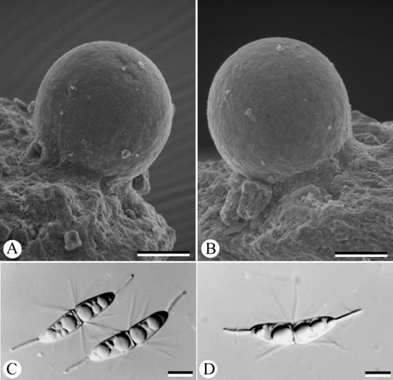 Corollospora maritima. A. ascoma with ostiole at basal region; B. ascoma with basal subiculum attached to substrate; C, D. ascospores. Scale bars: A, B= 50 μm; C, D= 10 μm. 