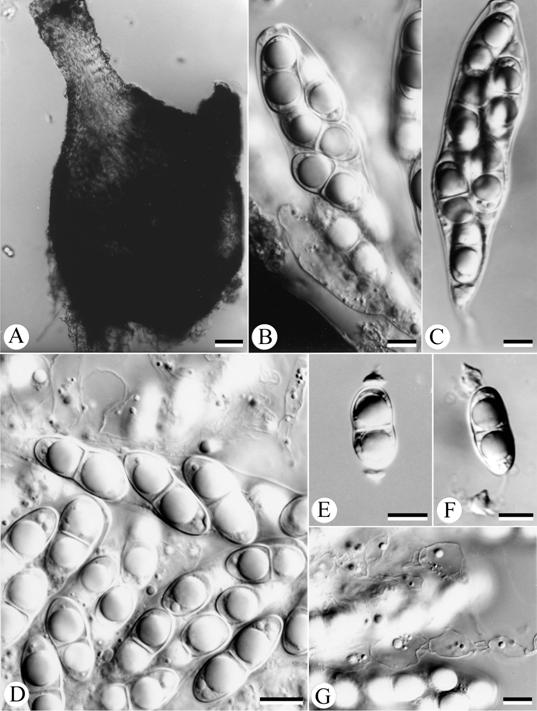 Halosarpheia marina. A. ascoma; B, C. asci; D, F. ascospores; G. catenophyses. Scale bars: A= 50 μm; B-G= 10 μm. 