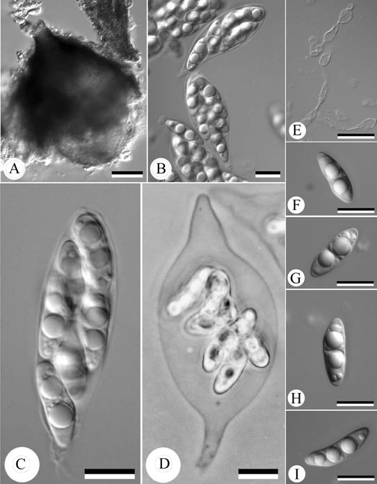 Lignincola laevis. A. ascoma; B, C. asci; D. expended ascus; E. catenophyses. F, I. ascospores. Scale bars: A= 50 μm. B-I= 10 μm. 