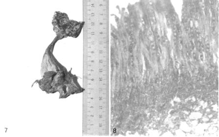 Helvella infula. Specimen No.201. A. A mature fruit body. B. Longisection of the hymenial layer. (x350). C. Fruit body. D. Ascospores in an ascus. E. An ascus showing a minute pore at the apex. F. Paraphyses with septa. G. Ascospores containing two oil drops each. 