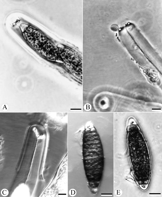 Aigialus parvus. A. Ascus with apical refractive ring. B. Discharged ascus, a ring at the tip of endoascus. C. Bitunicate ascus, ectoascus has ruptured. D. & E. Ascospores with gelatinous caps. All scale bars = 10 μm. 