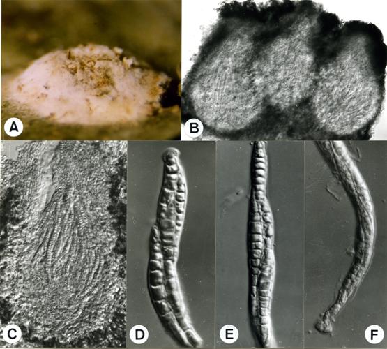 Podonectria aurantii. A-D. Asci with ascospores. E. Ascospores. 