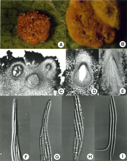 Podonectria coccorum. A. Tips of mature asci. B. Base of ascus. C. Ascospores. D. Ascostroma containing several aggregated perithecia. 