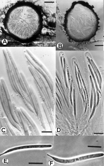 Lasiosphaeria breviseta: A-B. V.s. of ascomata. C-D. Asci with ascospores, (C, bar=10 μm; D, bar=15 μm). E-F. Ascospores, bar15 μm. 