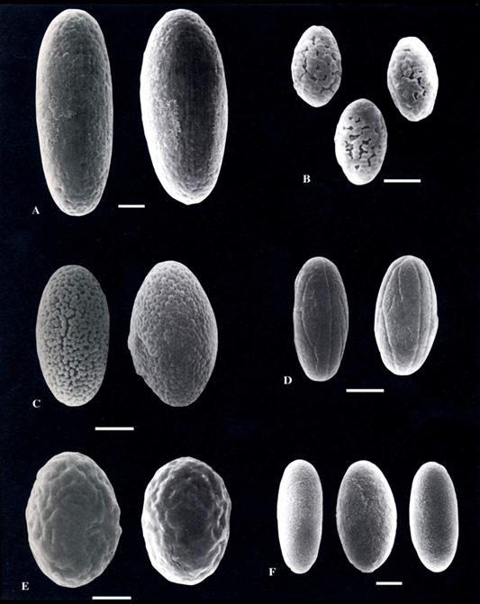 (SEM) Ascospores of A. Ascobolus immersus. B. A. lineolatus. C. A. mancus. D. A. michaudii. E. A. reticulatus. F. A. scatigenus. Bar = 5 μm. 