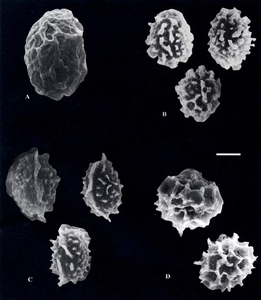(SEM) Ascospores of A. Ascodesmis macrospora. B. A. nigricans. C. A. porcina. D. A. sphaerospora. Bar = 5 μm. 