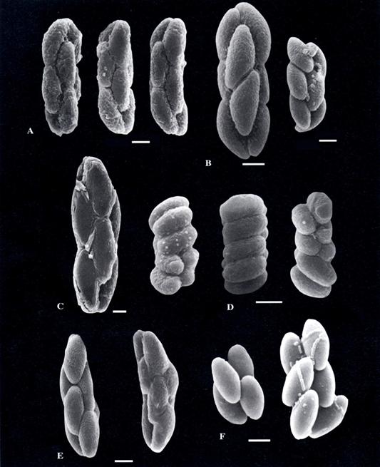 (SEM) Ascospores of A. Saccobolus citrinus. B. S. depauperatus. C. S. glaber. D. S. infestans. E. S. minimus. F. S. michiganensis. Bar = 5 μm. 