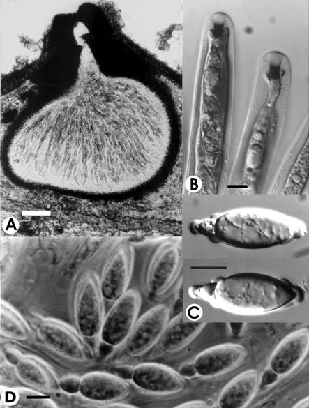 Anthostomella castnopsis. A. V.s. of ascoma, Bar.=100 μm. B. Amyloid apical rings, Bar.=10 μm. C-D. Ascospores, Bar=10 μm. 