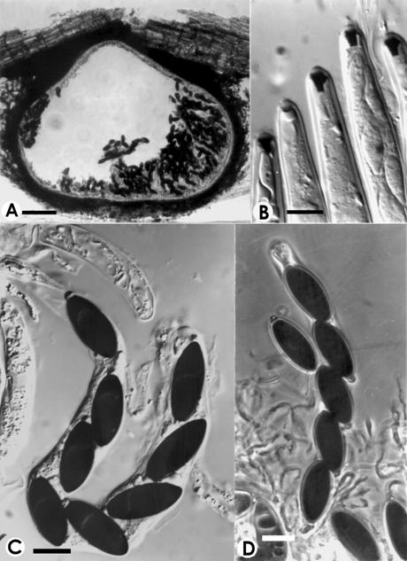 Anthostomella cornicola. A. V.s. of ascoma, Bar=75 μm. B. Amyloid apical rings of asci, Bar=10 μm. C-D. Asci and ascospores, Bar=10 μm. 
