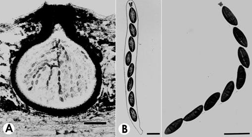 Anthostomella longispora. A. V.s. of ascoma. Bar=100 μm. B. Asci with ascospores, Bar=20 μm. 