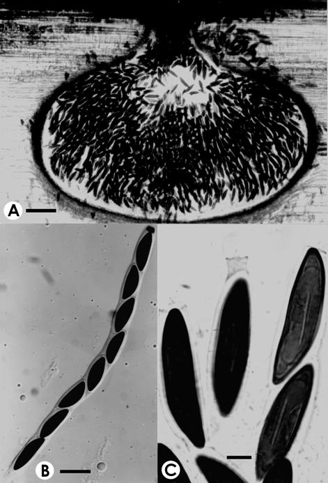 Anthostomella yushaniae. A. V.s. of ascoma, bar=80 μm. B. Asci, bar=30 μm. C. Ascospores, bar= 10 μm. 