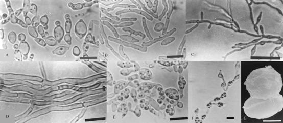 Morphology of Arthroascus fermentans (BCRC 22530) A. Septa between cells and buds. B. Elongate cells. C. Pseudomycelium. D. True mycelium. E. Conjugation and ascus formation. F. Pseudomycelium containing spores. G. Spore morphology by scanning electron microscopy. Bar = 10 µm. 