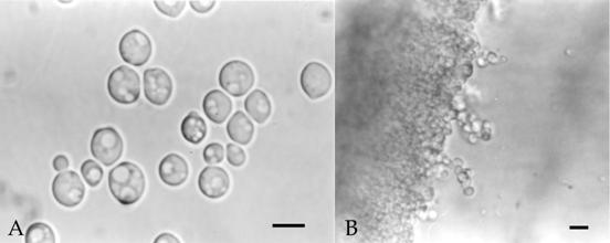 Morphology of Candida humilis (BCRC 23045) A. Vegetative cells grown in glucose-yeast extract-peptone broth for 3 days at 25°C. Bar = 5 µm. B. Rudimentary pseudohyphae grown in CMA agar for 7 days at 25°C. Bar = 10 µm, photographs by light microscope. 