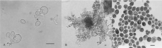Morphology of Saccharomyces cerevisiae (BCRC 21849) A. Vegetative cells grown in glucose-yeast extract-peptone broth for 3 days at 25°C. Bar = 5 µm. B. Pseudohyphae grown in CMA agar for 7 days at 25°C. Bar = 10 µm. C. Asci with ascospores grown in Kleny’s medium for 7 days at 25°C. Bar = 5 µm. Photographs by light microscope. 