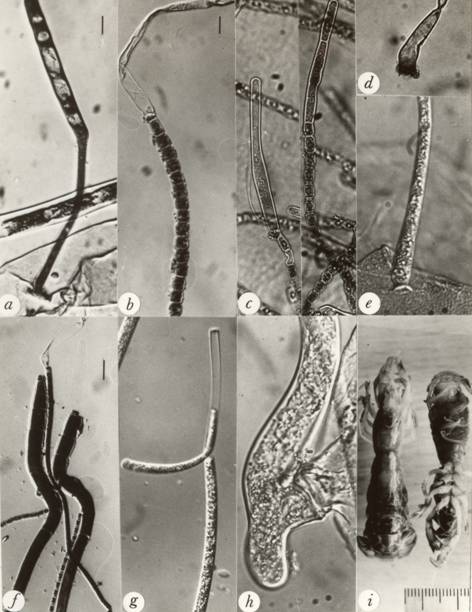Enteropogon formosensis. a. A young thallus. b. Uninucleate thick-walled spores from an exuvium. c. Thalli forming spores. d. A thallus from exuvium. e. A thallus with a holdfast. f. Two thalli seen parallel to each other. g. Multinucleate spore being release. h. Thallus with a holdfast. i. Host, Upogebia edulis. Bars: a-e, h = 10 μm; f-g = 20 μm, scale: i = 1 mm. 
