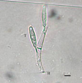 Stachylina nana. H. holdfast, T. trichospore. Bar=10 µm. 