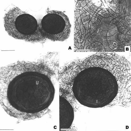 Micrographs of Peridiospora reticulata. A, Two unispored zygosporocarps enclosed by hy-phal peridia (P) (scale bar = 80 µm). B, Close up of interwoven peridial hyphae (scale bar = 20 µm). C, A mature spore enclosed by hyphal peridium (P). Note the polygonal reticulum structure and an opening of gametanfial union (U) on spore surface (scale bar = 40 µm). 
D, A continuous inner wall (I) of a zygospore (scale bar = 40 µm). 