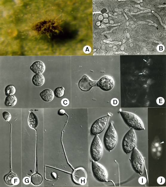 Neozygites floridana. A. Dead two-spotted mite attached to a leaf. B. Hyphal bodies and primary conidia, 350X. C. Primary conidia, 850X. D. Formation of secondary conidia, 1060X. E. Primary conidia with nuclei (arrows), 320X. F. Formation of capilliconidia, note the curved capilliphore, 885X. G. Capilliconidia with distal adhesive sac (arrow), attached on the curved top of capillary tube arising from primary conidia (arrow head), 895X. H. Formation of two capilliconidia from a primary conidium, 870X. I. Capilliconidia, 1070X. J. Tetranucleate capilliconidium (arrow head), 910X. 
