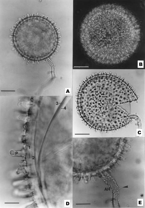 Microgarphs of Glomus chimonobambusa. A, A chlamydospore and its blut projections (scale bar = 40 μm). B, Outer spore wall not only ornamented by long projections but also by minute wars. (arrows) (scale bar = 40 μm). C, A broken spora showing four walls. Note wall 1 decorated by blunt projections (P) and minute warts (arrows) (scale bar = 8 μm). E, A warted attachment hypha and a slender branch (arrowhead) (scale bar = 20 μm) 
