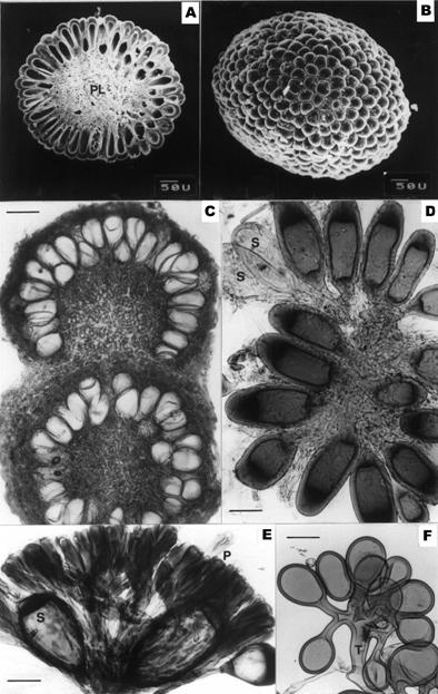 Micrographs of sporocarps of Sclerocystis spp. A. & B. Scanning electron micrographs of S. clavispora. A. Cross section of a sporocarp of S. clavispora. Showing chlamydospores radially arranged on plexus (PL). B. Surface view of sporocarp of S. clavispora showing exposed chlamydospores. C. Sporocarps of S. coremioides formed in chain, scale = 70 μm. D. Park of a sporocarp of S. clavispora showing clamydoporoes variable in size and some young spores in the vesicular stage (S), scale = 35 μm. E. Part of a sporocarp of S. liquidambaris showing chlamydospores embedded in “paraphysis-like” structures (P), scale = 35 μm. F. Young sporocarps of S. rubiformis in fam shape and connected with a hyphal sralk (T). 