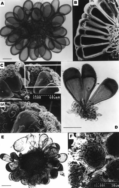 Micrographs of sporocarps of Sclerocystis spp. A. Globular sporocarp of S. rubiformis, scale = 35μm. B. Scanning electron micrograph of S. taiwanensis, showing chlamydospores tightly arranged on plexus. C. Scanning electron micrograph of S. sinuosa showing sinuous peridium. 9A. Close up (2 × magnification) of figure D showing sinuous hyphae attached to chlamydospores. D. Thress chlamydospores of S. taiwanensis connected to plexal hypha. Note the hyaline, separable outer wall (arrow heads) of chlamydospores, scale = 35μm. E. After peridium detached, sporocarps of S. sinuosa showing heterogenous types of chlamydospores, scale = 70μm. F. Inner side of peridium of S. sinuosa also showing sinuous pattern. 