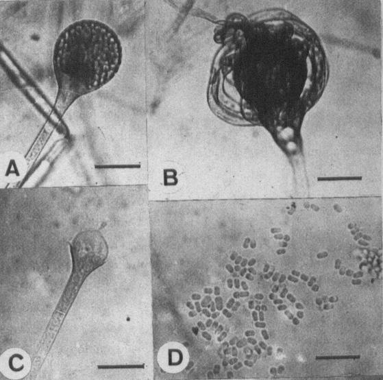 Absidia spinosa. A-D, LM. A. Mature sporangium. Bar = 26μm; B. Mature zygospore with finger-like projections growing from the larger suspensor. Bar = 52μm; C. Columella with spine and apophysis. Bar = 26μm; D. Cylindrical Sporangiospores. Bar = 35μm. 